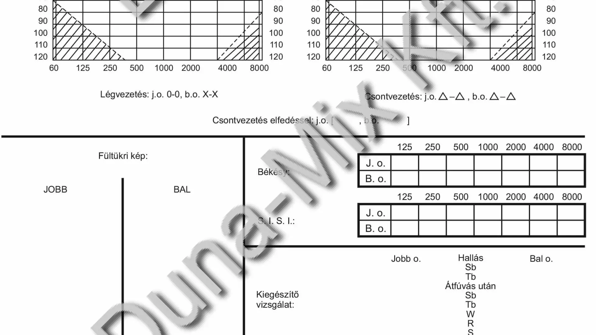 Audiogram
