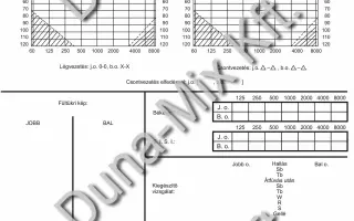 Audiogram 1