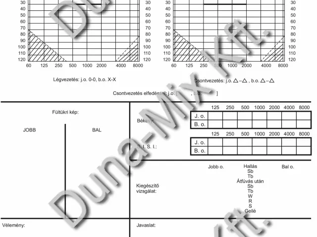 Audiogram
